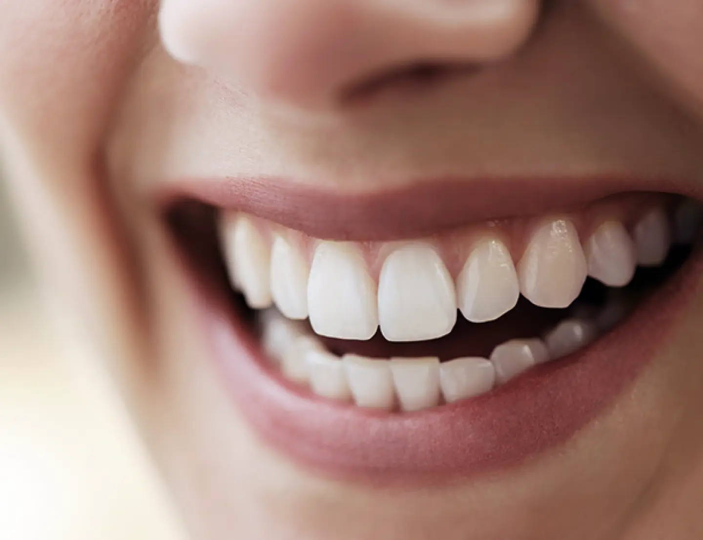 blanchiment-dentaire-thumb