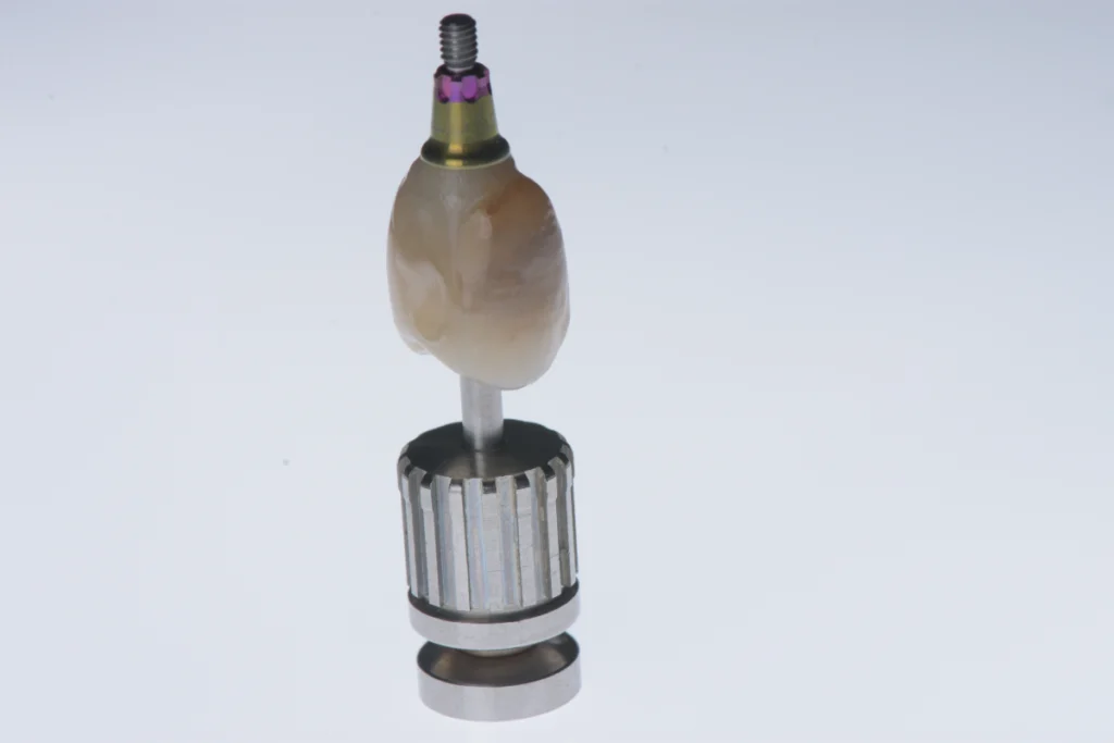 implant dentaire structure